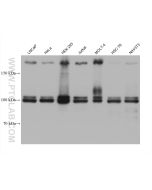 BRD3 Monoclonal antibody 60971-1-Ig proteintech