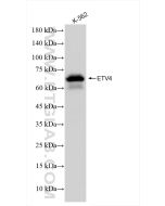 ETV4 Recombinant monoclonal antibody Proteintech  83891-6-RR