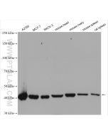 DHODH Polyclonal antibody Proteintech  14877-1-AP