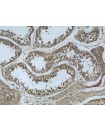 MAD2L1 Monoclonal antibody, PBS Only 66014-1-PBS proteintech