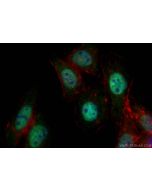 Transketolase Monoclonal antibody, PBS Only 66016-1-PBS proteintech