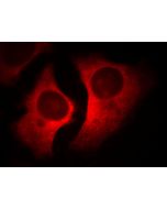 RACGAP1 Monoclonal antibody 66056-1-Ig proteintech