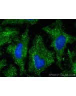 IFITM2/3 Monoclonal antibody 66081-1-Ig proteintech