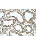 P4HA1 Monoclonal antibody, PBS Only 66101-1-PBS proteintech