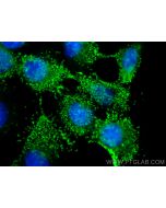 CSK Monoclonal antibody, PBS Only 66115-1-PBS proteintech