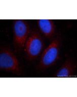 Alpha Galactosidase A Monoclonal antibody, PBS Only 66121-1-PBS proteintech