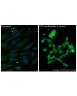 IL-6 Monoclonal antibody 66146-1-Ig proteintech