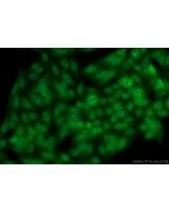 p38 MAPK Monoclonal antibody 66234-1-Ig proteintech