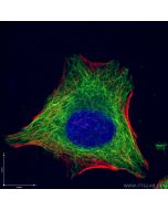 Beta Tubulin Monoclonal antibody 66240-1-Ig proteintech