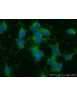 APOA4 Monoclonal antibody 66252-1-Ig proteintech