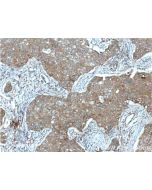 IGF1R/CD221 Monoclonal antibody 66283-1-Ig proteintech