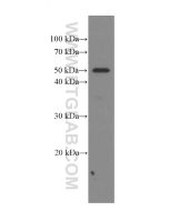 Phospho-TDP43 (Ser409/410) Monoclonal antibody, PBS Only 66318-1-PBS proteintech