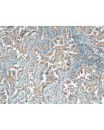 IGSF2/CD101 Monoclonal antibody, PBS Only 66333-1-PBS proteintech