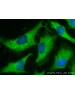 NAMPT/PBEF Monoclonal antibody 66385-1-Ig proteintech