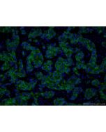 PADI2 Monoclonal antibody 66386-1-Ig proteintech