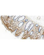 Periostin Monoclonal antibody 66491-1-Ig proteintech