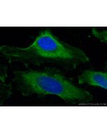 MYPT1 Monoclonal antibody 66506-1-Ig proteintech