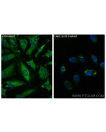 Perilipin 3/TIP47 Monoclonal antibody 66523-1-Ig proteintech