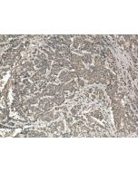 Palladin Monoclonal antibody 66601-1-Ig proteintech