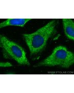 PPP3CB Monoclonal antibody 66614-1-Ig proteintech