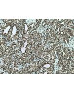 FAF2 Monoclonal antibody 66629-1-Ig proteintech