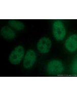 SRF Monoclonal antibody 66742-1-Ig proteintech