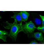 Cytokeratin 16 Monoclonal antibody, PBS Only 66802-1-PBS proteintech