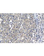 B7‑H4 Monoclonal antibody, PBS Only 66817-1-PBS proteintech