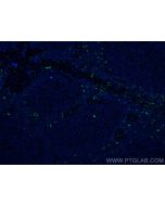 S100A8 Monoclonal antibody 66853-1-Ig proteintech