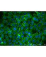 Integrin beta 4 Monoclonal antibody 66922-2-Ig proteintech
