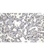 CD61 / Integrin beta 3 Monoclonal antibody 66952-1-Ig proteintech