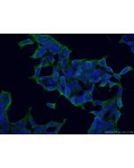 COPE Monoclonal antibody 66994-1-Ig proteintech