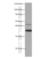 CRK Monoclonal antibody 67035-1-Ig proteintech