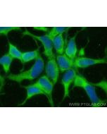 ESD Monoclonal antibody, PBS Only 67069-2-PBS proteintech