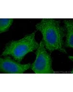 ASAH1 Monoclonal antibody 67092-2-Ig proteintech