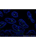 PLVAP Monoclonal antibody 67158-1-Ig proteintech