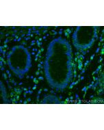 HIP1 Monoclonal antibody 67163-1-Ig proteintech