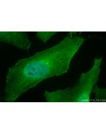 KIF20A Monoclonal antibody 67190-1-Ig proteintech