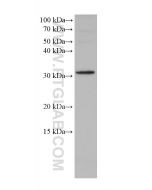 PITX2 Monoclonal antibody 67201-1-Ig proteintech