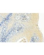 DAAM1 Monoclonal antibody 67287-1-Ig proteintech