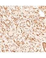 TFE3 Monoclonal antibody 67319-1-Ig proteintech