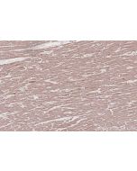 TUSC3 Monoclonal antibody 67382-1-Ig proteintech