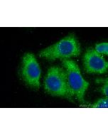 CCT5 Monoclonal antibody, PBS Only 67400-1-PBS proteintech