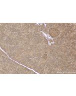 VAT1 Monoclonal antibody, PBS Only 67474-1-PBS proteintech