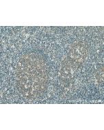 PIP5K1A Monoclonal antibody, PBS Only 67483-1-PBS proteintech