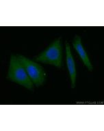 GPT/ALT1 Monoclonal antibody 67531-1-Ig proteintech