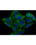 RAB8A Monoclonal antibody, PBS Only 67536-1-PBS proteintech