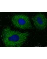 HSD3B2 Monoclonal antibody, PBS Only 67572-1-PBS proteintech