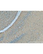 Drebrin Monoclonal antibody 67589-1-Ig proteintech