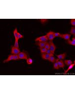 NOXA2/p67phox Monoclonal antibody 67594-1-Ig proteintech